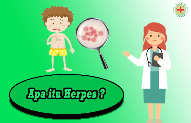 Apa itu Herpes? Pahami Gejala dan Cara Mengobatinya