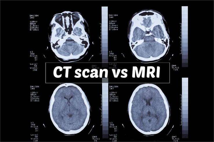 Inilah Perbedaan Antara CT Scan dan MRI