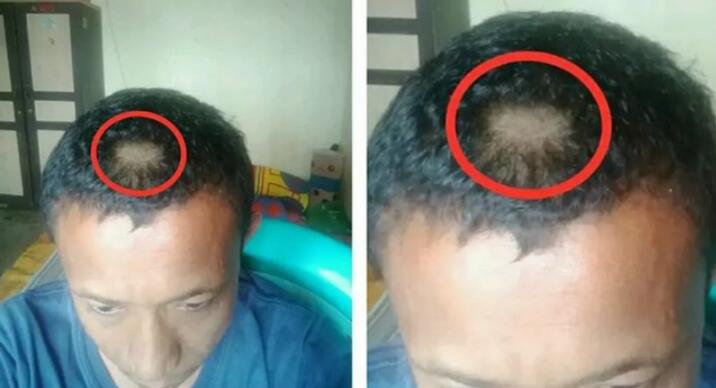 Miris, Seorang Guru Dicukur Paksa Wali Murid karena Emosi Rambut Anaknya Digunting