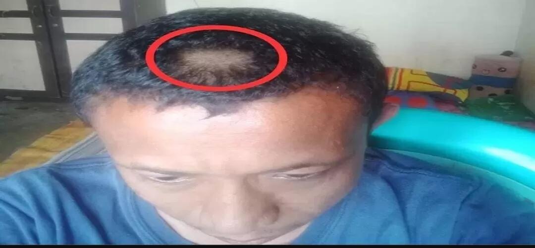 Miris, Seorang Guru Dicukur Paksa Wali Murid karena Emosi Rambut Anaknya Digunting