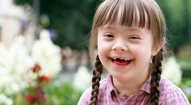 Mengenal Tentang Anak Down Syndrome Atau Trisomi 21, Tidak Untuk Dihina dan Dibully