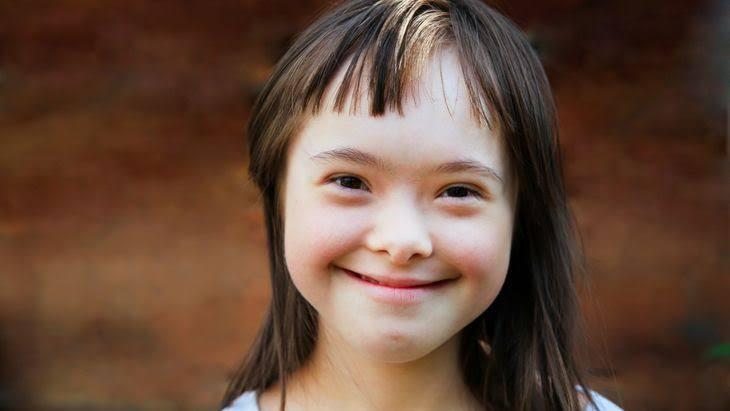 Mengenal Tentang Anak Down Syndrome Atau Trisomi 21, Tidak Untuk Dihina dan Dibully