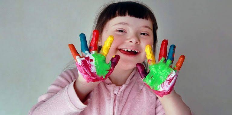 Mengenal Tentang Anak Down Syndrome Atau Trisomi 21, Tidak Untuk Dihina dan Dibully