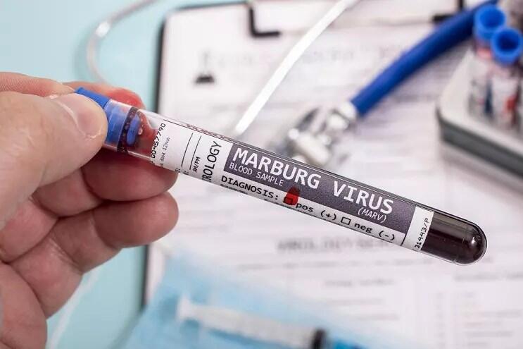 Virus Mematikan Marburg Merebak di Afrika