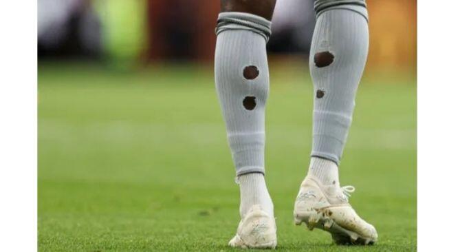 Kaos Kaki Bolong Dan Mini Soccer, Bukan Sekedar Gaya Tapi Ada Alasan Fisiologis