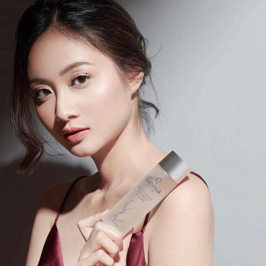 Duh Cantiknya Shindy Huang Buat Penggemar Terpukau