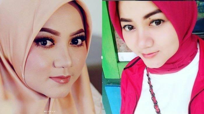 6 Tahun Setia Dampingi Kurnia Meiga yang Sakit, Mantan Model ini Patut Jadi Inspirasi