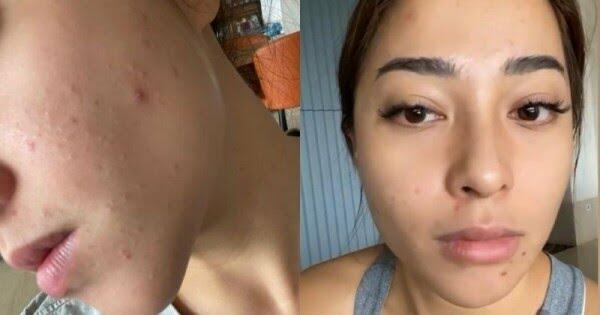 Masalah Anak Muda Tak Kalah Banyak dari Orang Dewasa Lho Gansist, Ini 5 Diantaranya!