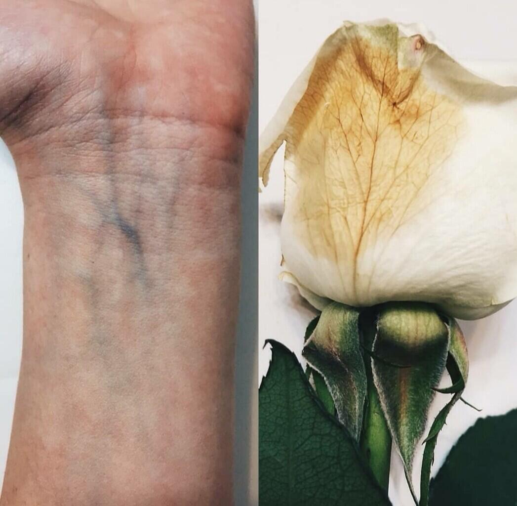 6 Potret Inspiratif yang Menunjukkan Alam Memiliki Wujud Seperti Tubuh Manusia