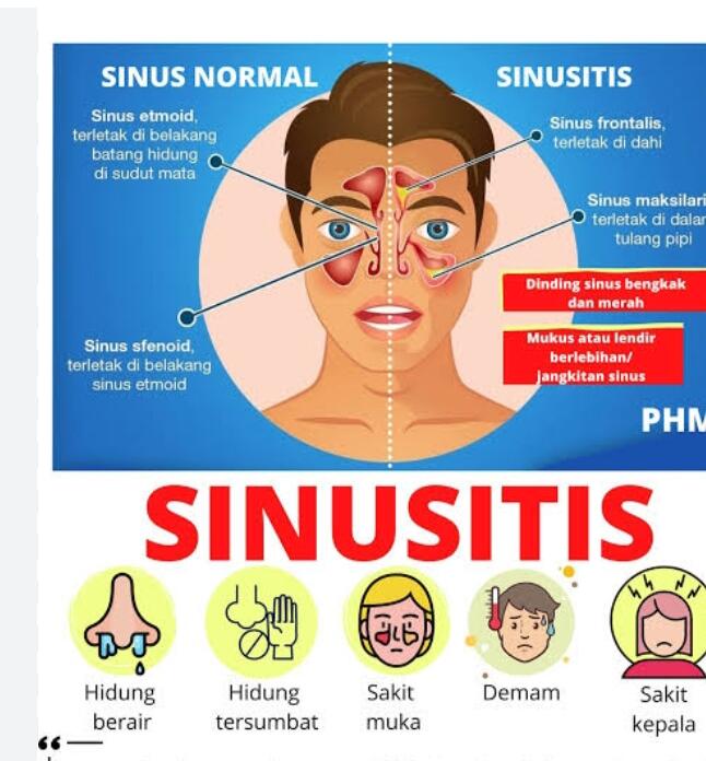 Catatan Penderita Sinusitis Dan Rhinitis
