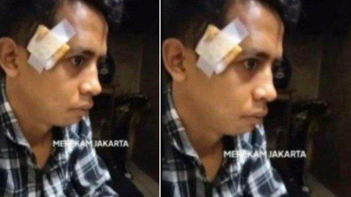 Kena Jambret Handphone, Warga Malah Gebukin Korbannya! Kok Bisa?