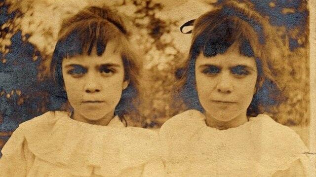 ANEH , MISTERI THE POLLOCK TWINS