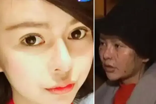 Iri: Wanita ini tega mencakar wajah temannya sendiri karena dianggap terlalu cantik
