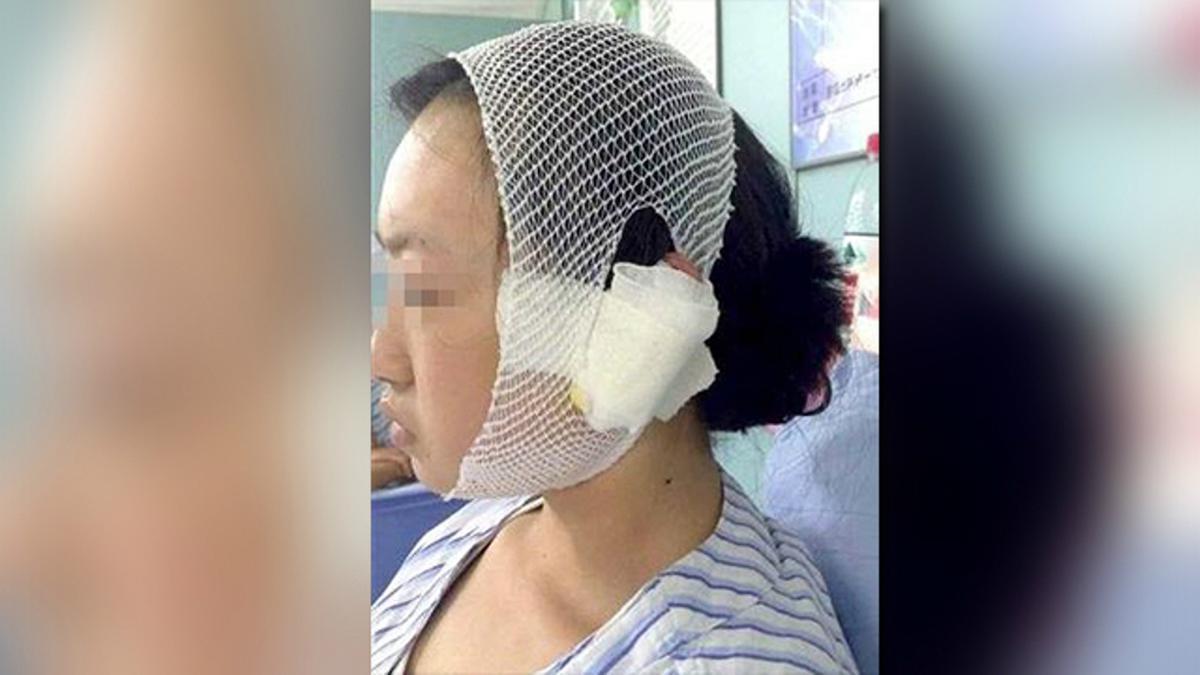 Iri: Wanita ini tega mencakar wajah temannya sendiri karena dianggap terlalu cantik