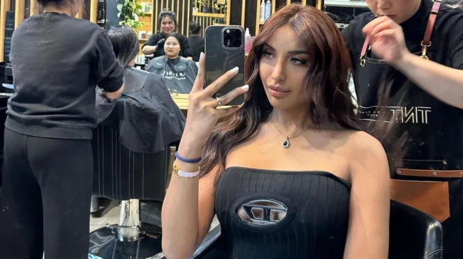 Penampilan Millen Cyrus Setelah Operasi Plastik Buat Netizen Gagal Fokus