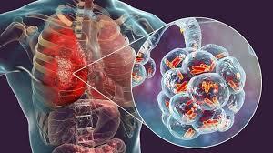 Heboh Virus Pneumonia Mysterius Menyerang China, Warganet Sibuk Bahas Hal Ini!