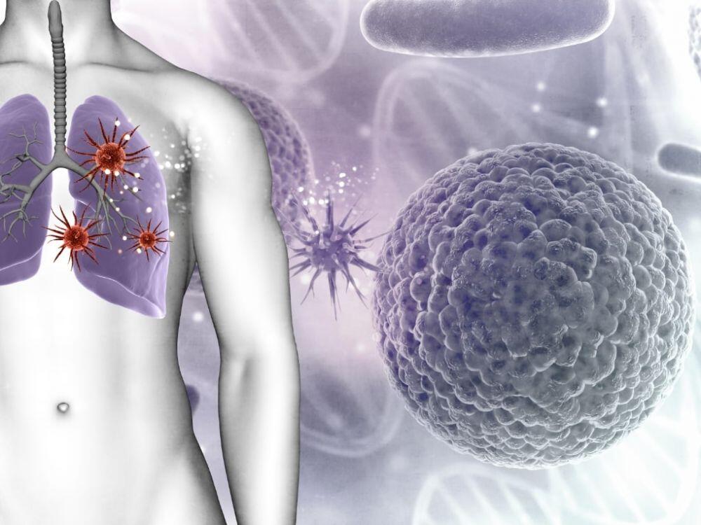 10 Gejala Mycoplasma Pneumoniae, Penyakit Berbahaya Sudah Masuk Indonesia!