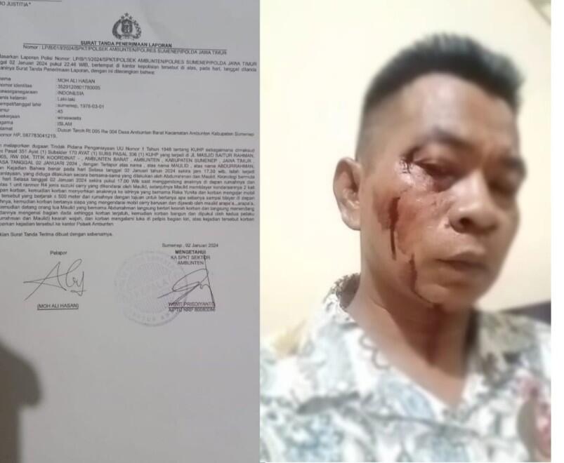 Jadi Korban Pengeroyokan 2 Guru Ngaji, Wartawan Lapor Polisi