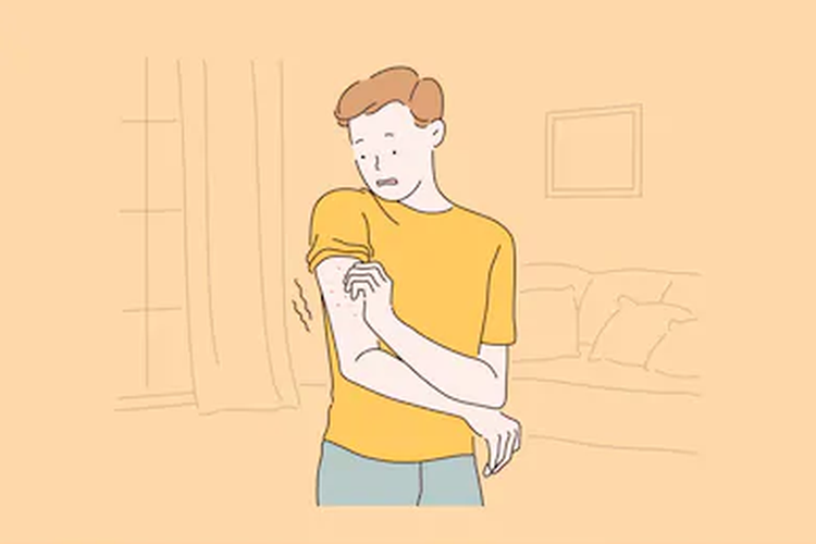 Tips Mencegah Biduran agar Tidak Kambuh Lagi ( Ada Yang Pernah Ngalamin ? )