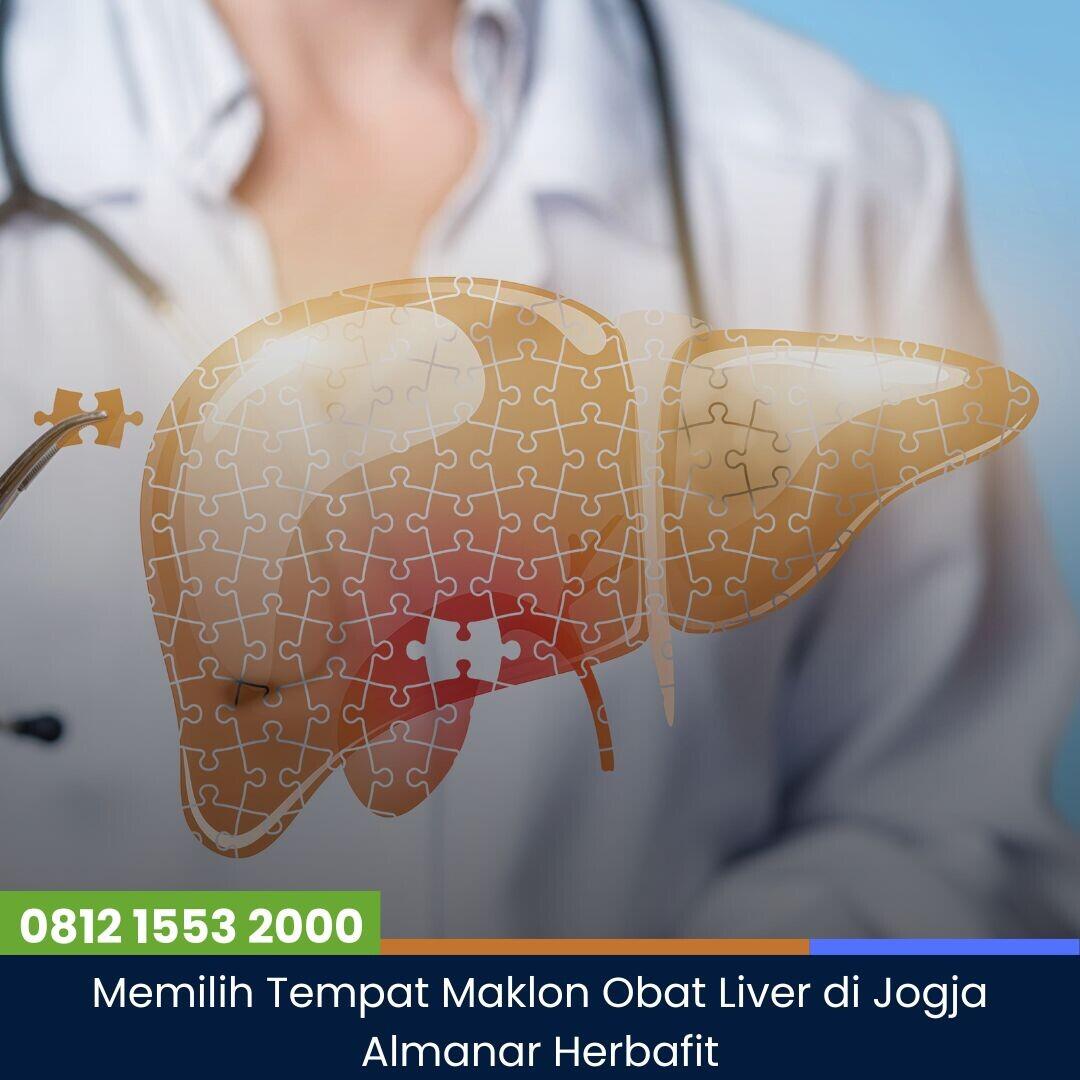 Ini Tempat Produksi Obat Liver Terbaik