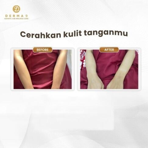 Tentang Kecantikan yang Bersinar dengan Lulur Ekstrak Bengkoang: Mitos atau Fakta?