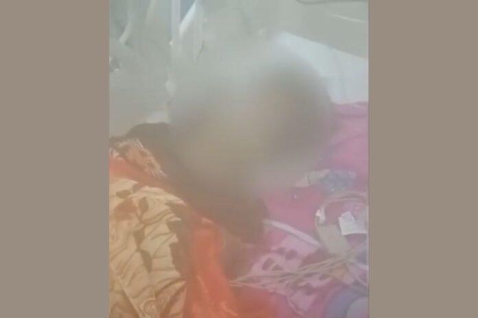 Santriwati Ponpes di Lombok Dianiaya Teman Pakai Balok Kayu, Kondisinya Kini Kritis