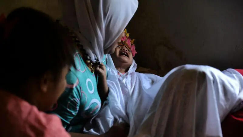Apa itu sunat perempuan dan mengapa itu dilakukan?