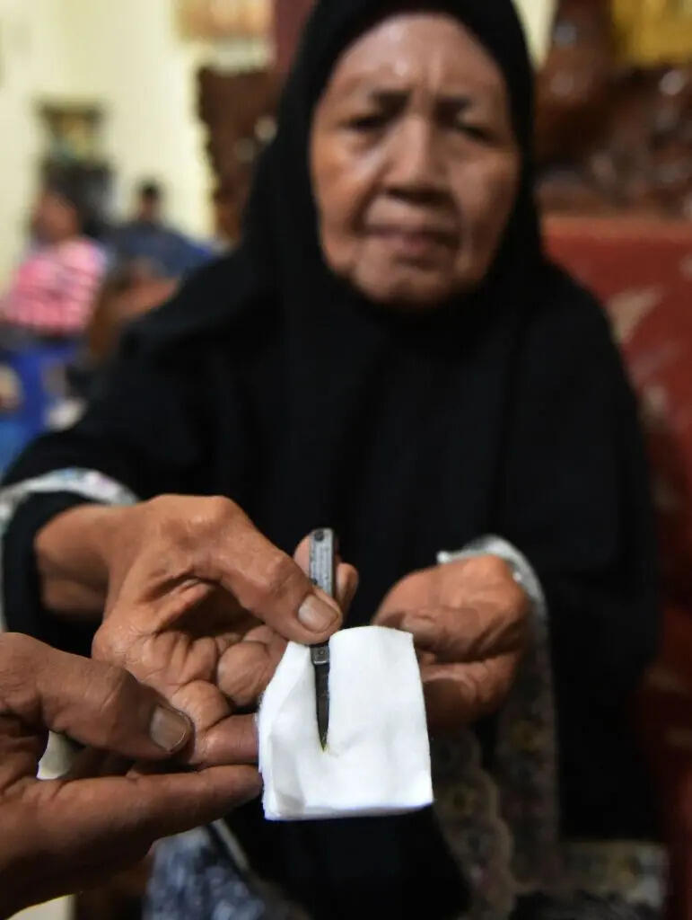 Apa itu sunat perempuan dan mengapa itu dilakukan?