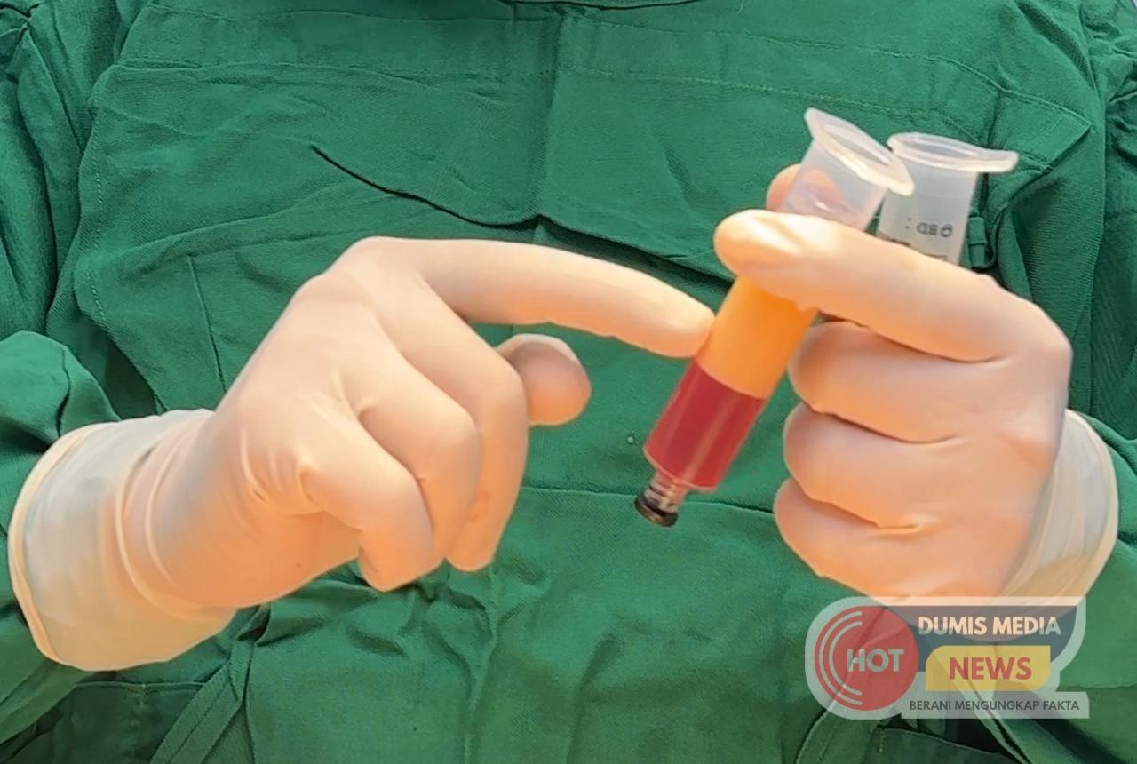 Keren! Dr. Ayu Widyaningrum Kembali Memperkenalkan Inovasi Terbarunya FAT FILLER