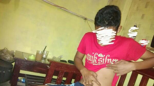 Kisah Ifan, Jual Ginjal Demi Beli HP dan PlayStation, 3 Hari Kemudian Hilang Dicuri!