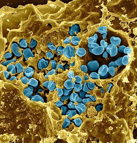 Tularemia, Penyakit Berbahaya Yang Ditularkan Oleh Kelinci