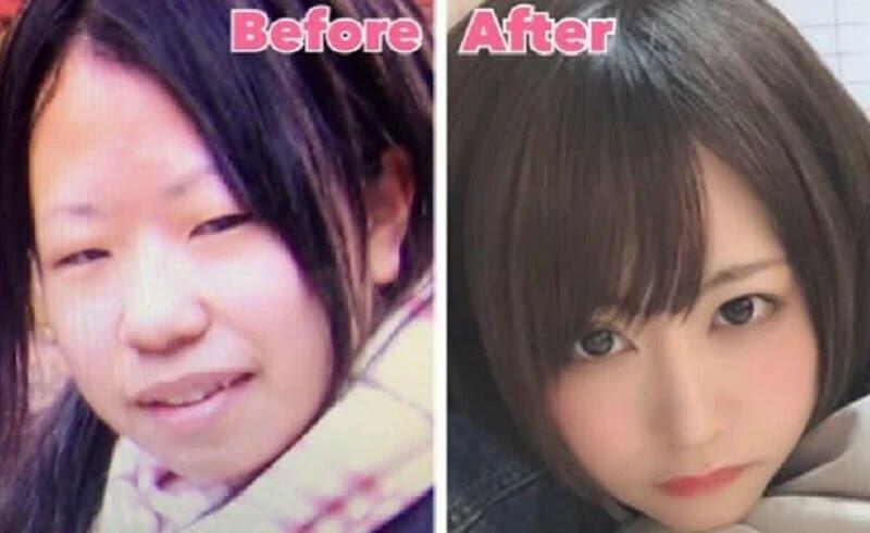 Kisah Mikishi, Gadis Jepang yang Dulu Dibilang Jelek Tapi Kini Jadi Cantik dan Sukses