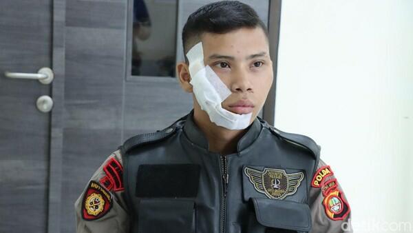 Ngeri! Pelaku Tawuran di Jakbar Siram Polisi dengan Air Keras, Ngaku karena Dendam