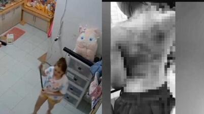 Ibu Cambuk Anak Umur 6 Tahun Gegara Stiker Hilang di Medan