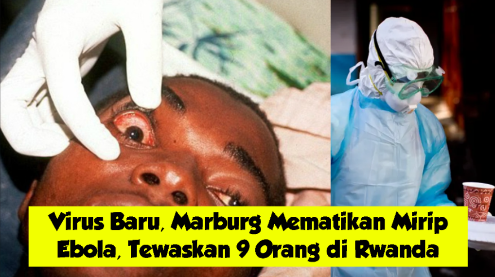 Virus Marburg Mematikan Mirip Ebola, Tewaskan 9 Orang di Rwanda