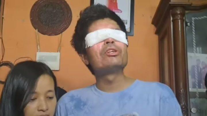 Viral Pengakuan Mantan Rekan Kerja Agus Salim, Korban Penyiraman Air Keras