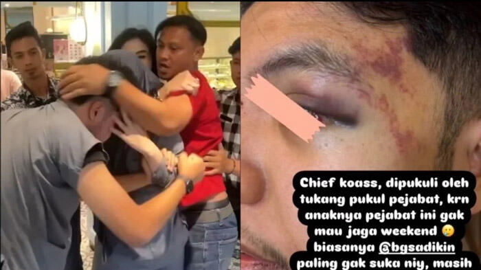 Luthfi Dokter Koas di RSUD Siti Fatimah Kena Bogem Supir Dokter Koas Lainnya