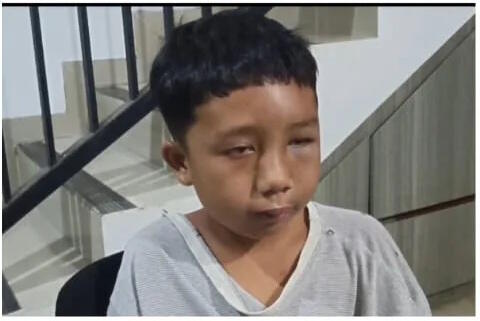 Santri Rava Alami Penganiaan Fisik Oleh Guru Pesantren, Keluarga Tuntut Jalur Hukum