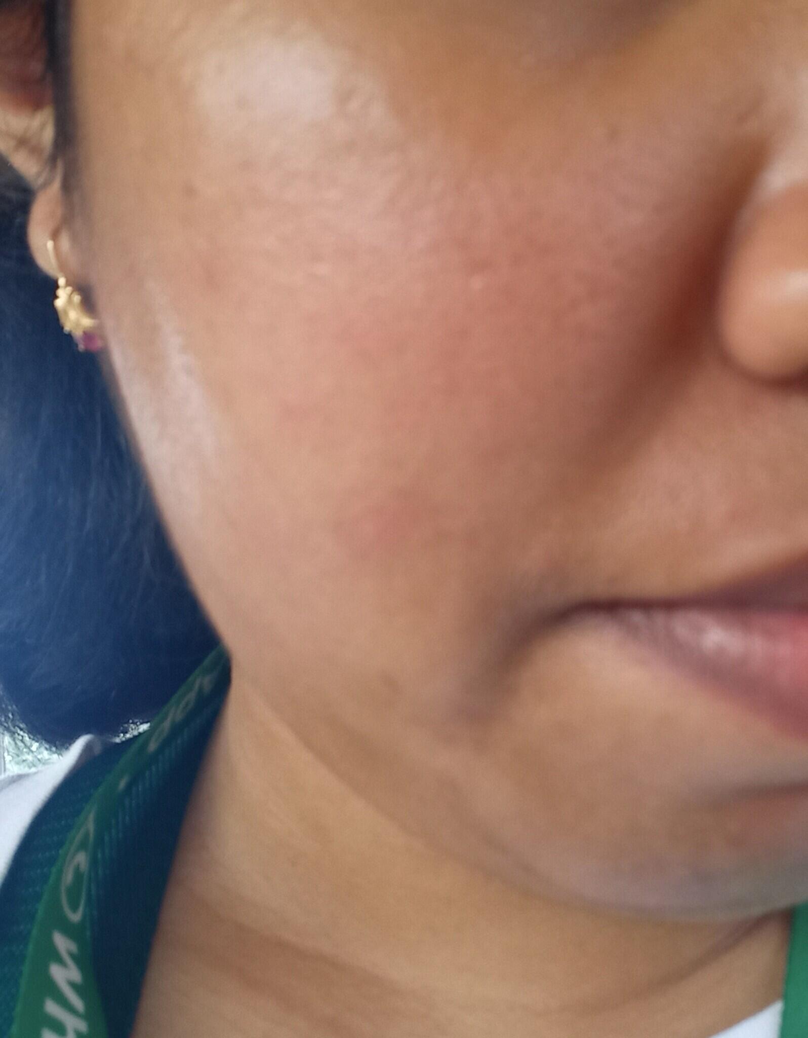Gue Sering Dikira Pakai Blush On Gara-gara 4 Kebiasaan Ini!