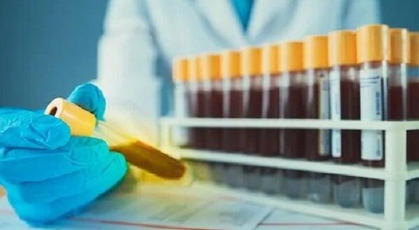 Golongan Darah Emas (Golden Blood): Fakta Menarik yang Jarang Diketahui