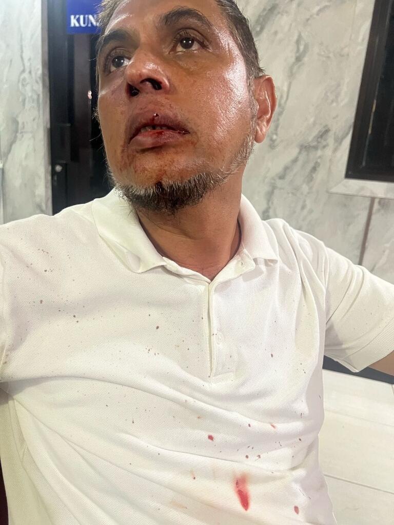 Niat baik mendamaikan, Ustadz Habib Abdul Hakim Jadi Korban Penganiayaan