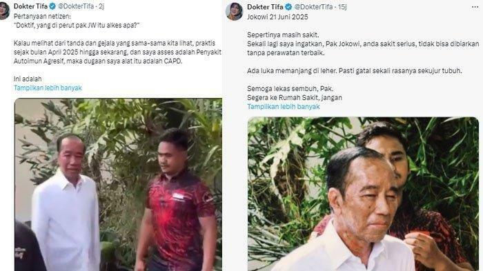 Dokter Tifa Soroti Tonjolan di Perut Jokowi: Anda Sakit Serius Harus ke Rumah Sakit