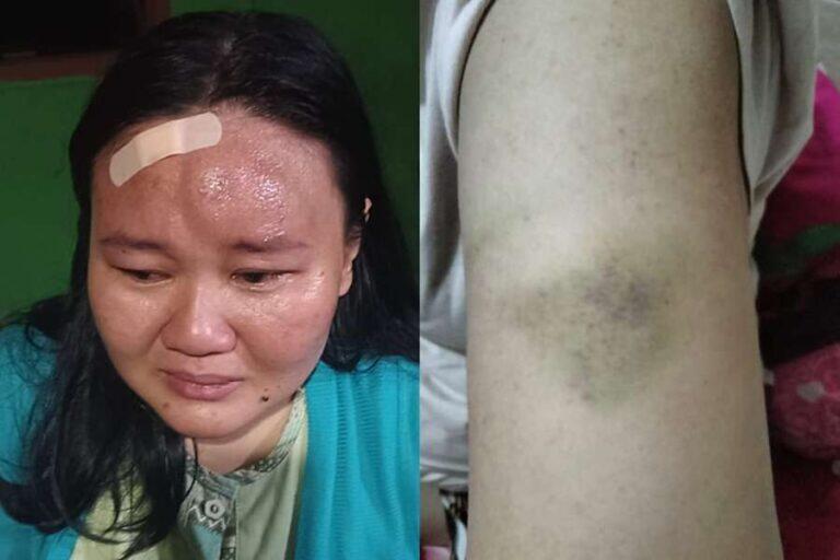 Suami Ketahuan Telpon Perempuan Lain, Istri di Surabaya Alami KDRT