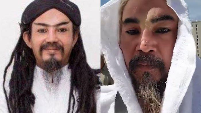 Sosok Limbad Ditahan di Imigrasi Arab Saudi Gegara Punya Taring
