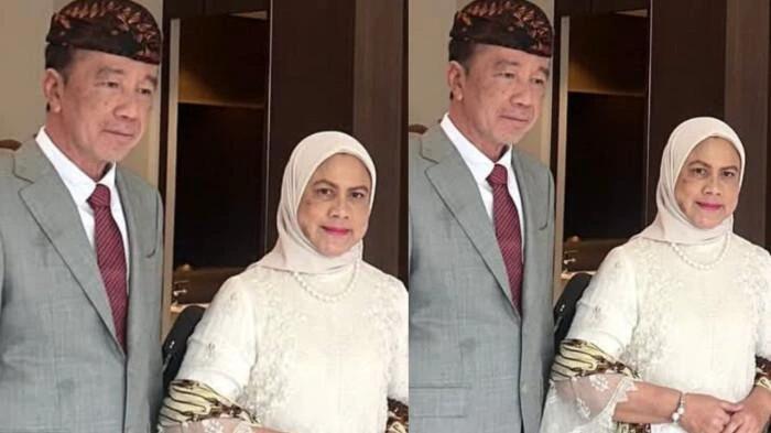 Jokowi Sudah 5 Bulan Belum Sembuh, Kulit Makin Putih dan Tak Bisa Kena Matahari