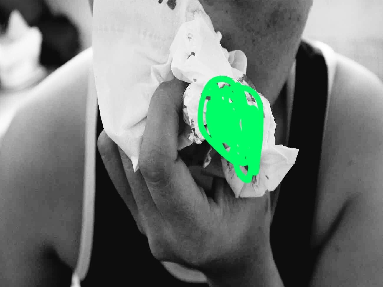 Mengapa Laki-laki Lebih Mudah Mimisan Daripada Perempuan?