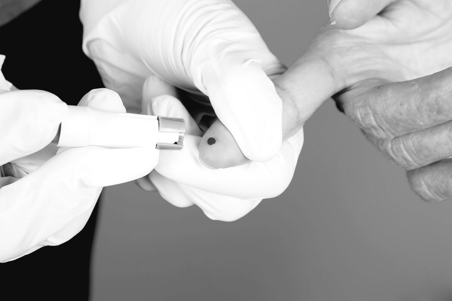 Parents, Ayo Deteksi Dini Leukemia Pada Anak Dengan 3 Cara Ini