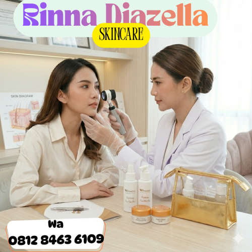 Cream Rinna Diazella menghidrasi kulit kering alami,Tegal