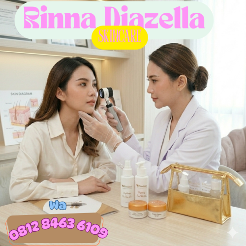 Skincare Rinna Diazella untuk kulit berjerawat,Cirebon