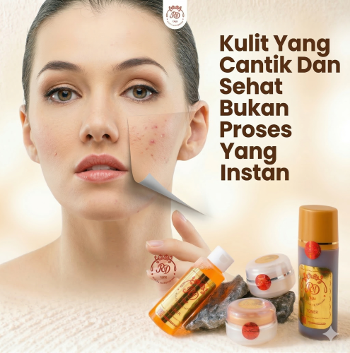 Paket Kulit Sensitif cream rd rinna diazella Toko Online Pangandaran 